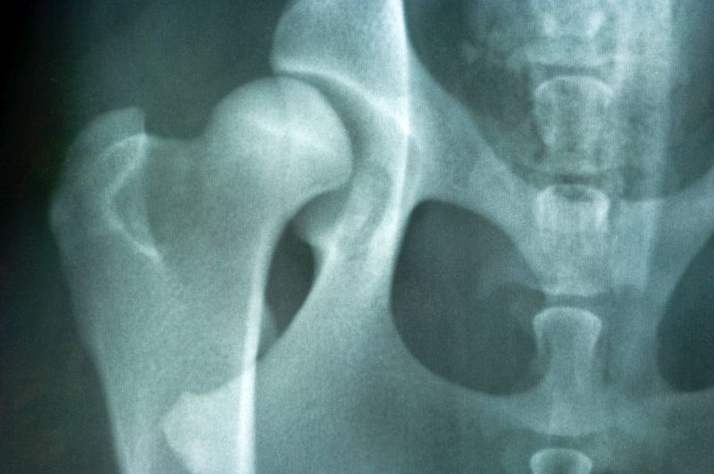 dog hip dysplasia